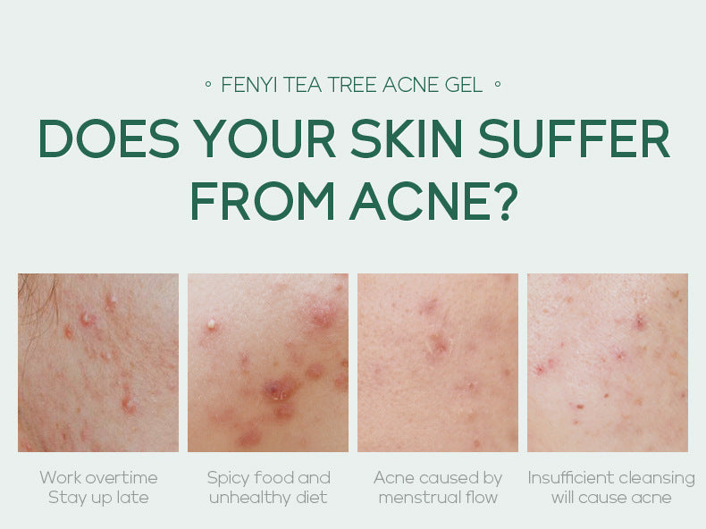 Gentle Acne Repair Gel for Clear, Calm Skin